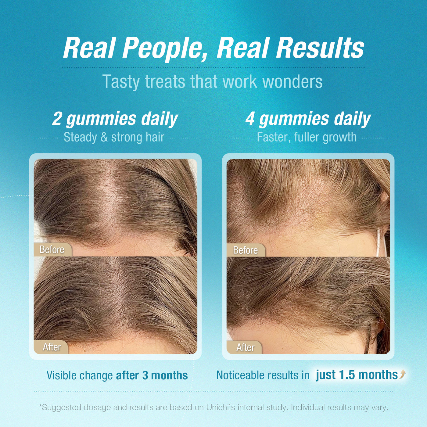 Unichi Hair Boost Gummy PLUS